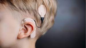 Cochlear Implant Surgery